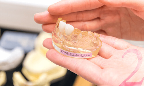 全身疾患まで考慮したオーダーメイド歯科治療